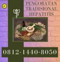 pengobatan hepatitis