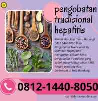 pengobatan hepatitis