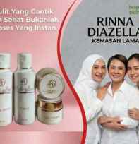 rinna diazella