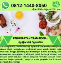 Pengobatan Herbal ny.