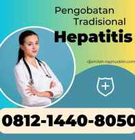 Pengobatan hepatitis