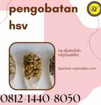 pengobatan hsv