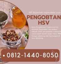 pengobatan hsv