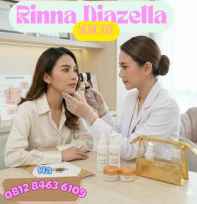 rinna diazella