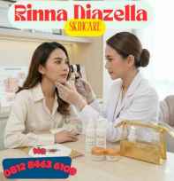 rinna diazella