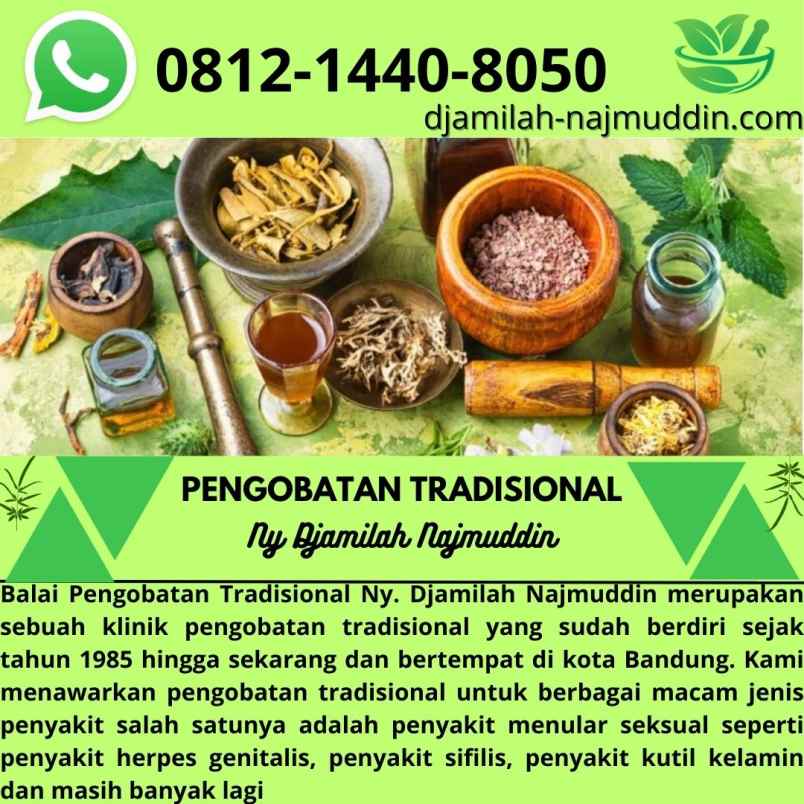 produk perawatan lengkong