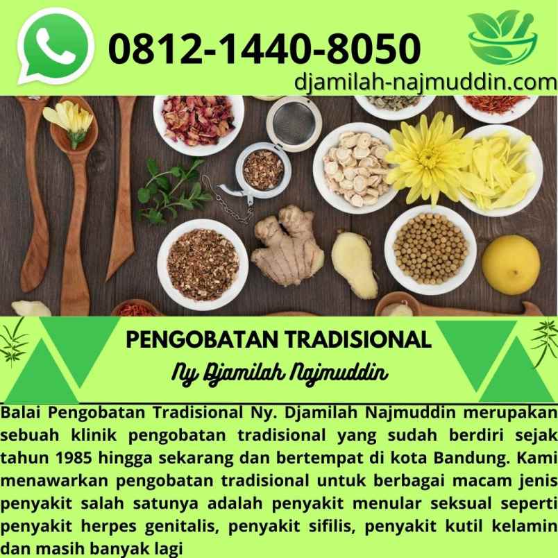 produk perawatan lengkong