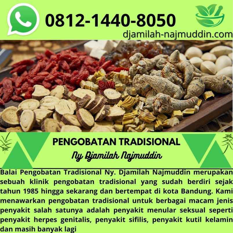 produk perawatan lengkong