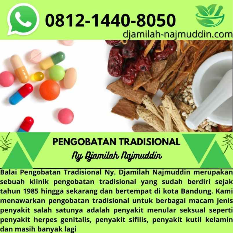 produk perawatan lengkong