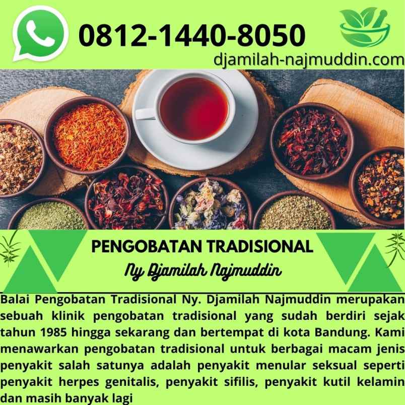 produk perawatan lengkong