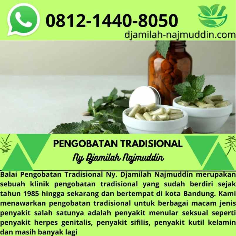 produk perawatan lengkong