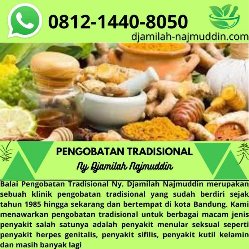 produk perawatan lengkong